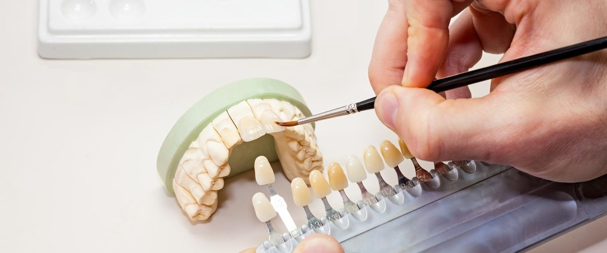 Изготовление зубных протезов в Обнинске